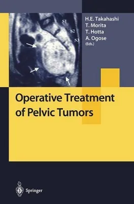 Obrázok produktu pre Operative Treatment of Pelvic Tumors