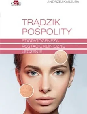 Image de Trądzik pospolity