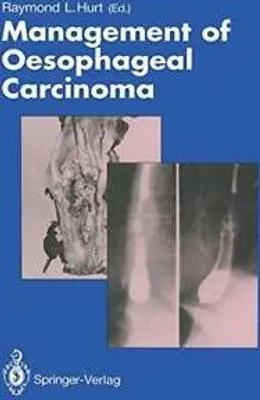 Obrázok produktu pre Management of Oesophageal Carcinoma