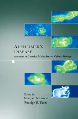 Obrázek produktu pro Alzheimer's Disease