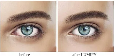 Produktbild von Lumify Augentropfen 2,5 ml