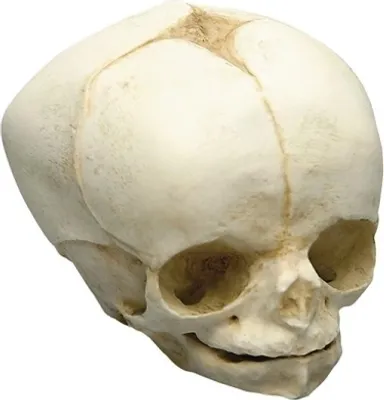 Image de Crâne fœtal, 34 semaines