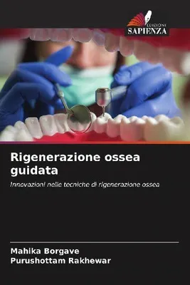 Produktbild von Rigenerazione ossea guidata