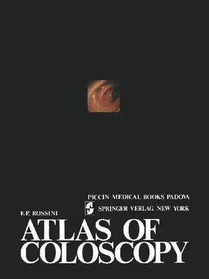 Produktbild von Atlas of coloscopy