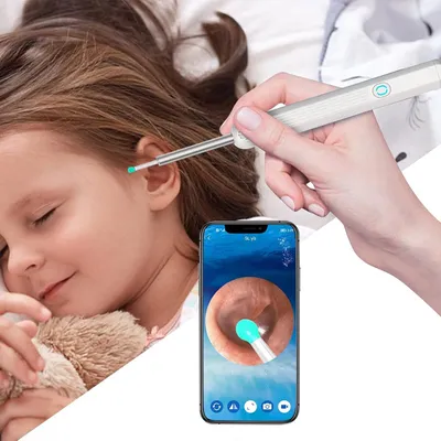Immagine prodotto di EarStick Otoscopio WiFi con Telecamera HD e LED – Pulitore Auricolare Wireless USB-C per iOS e Android, Endoscopio 360°