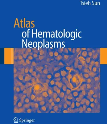 Produktbild von Atlas of Hematologic Neoplasms