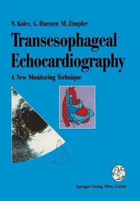 Produktbild von Transesophageal Echocardiography