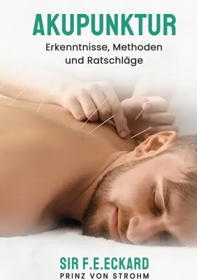 Produktbild von Akupunktur