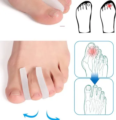 Obrázok produktu pre Jumada's - silikónový korektor prstov I rozťahovač prstov I gél I hallux valgus I vyhladzovanie I zariadenie na napínanie prstov I 2 kusy I biela farba