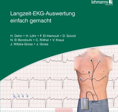 Image de Langzeit-EKG-Auswertung einfach gemacht