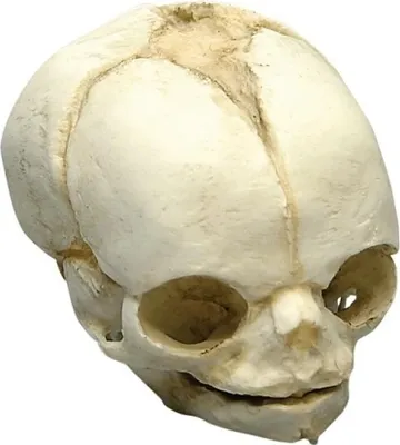 Image de Crâne du fœtus, 21 ½ semaines