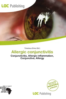 Produktbild von Allergische Konjunktivitis