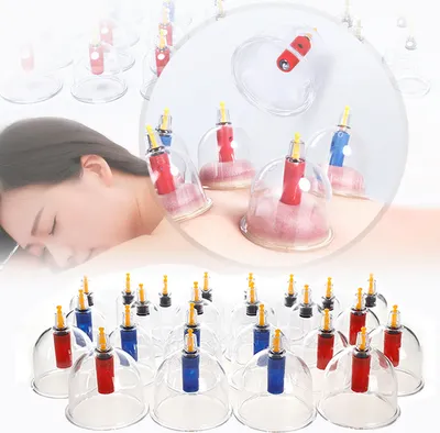 Produktbild von Schröpfen Set Vakuum Massage mit Schröpfgläser aus Plastik