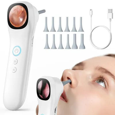Produktbild von Ohrenschmalz Entferner mit Otoskop (1,21" Bildschirm, 1080P) – Ohrkamera mit 4 LEDs, ideal für Erwachsene, Kinder & Haustiere – inkl. Foto & Video