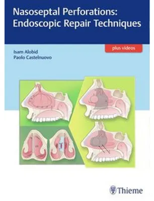 Obrázek produktu pro Nasoseptal Perforations: Endoscopic Repair Techniques