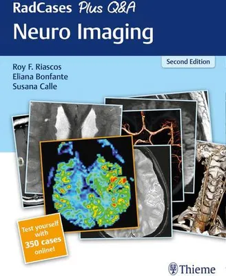 Produktbild von RadCases Plus Q&A Neuro Imaging