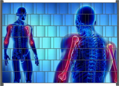 Produktbild von Wallario Zaunsichtschutz mit Motiv Anatomie Mensch  Oberarmknochen für Ein- und Doppelstabmatten Zäune in der Größe 200 x 140 cm
