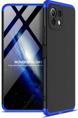 Produktbild von 360 Grad-Case für Xiaomi Mi 11 Lite 4G/5G  - Farbe: Schwarz & Blau - Modellkompatibilität: Für Xiaomi Mi 11 Lite 4G/5G