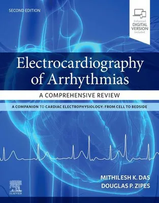 Obrázok produktu pre Electrocardiography of Arrhythmias: A Comprehensive Review