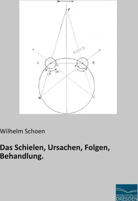 Produktbild von Das Schielen, Ursachen, Folgen, Behandlung.