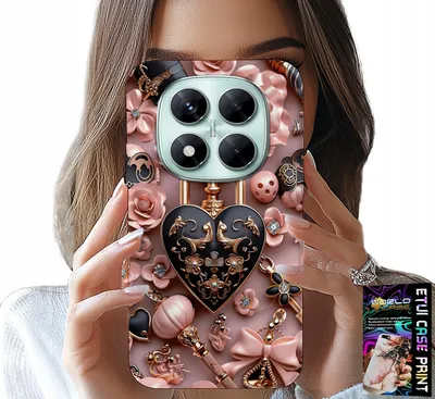 Produktbild von Fall Für Xiaomi Note 14 Pro 5G - Feminine Designs Vorhängeschloss Herz Fall + Glas