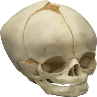 Image de Crâne fœtal, 40 ½ semaines
