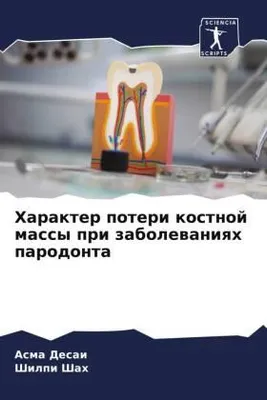 Produktbild von Harakter poteri kostnoj massy pri zabolewaniqh parodonta