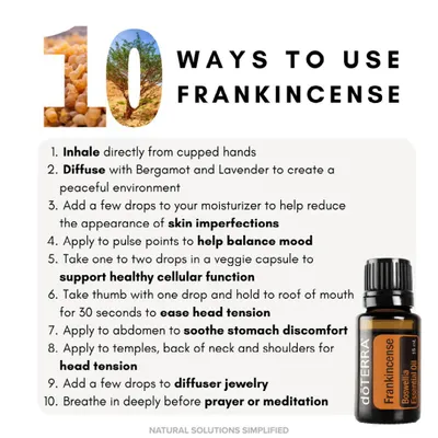 Produktbild von doTERRA Weihrauch 15 ml Boswellia Carterii, frereana, sacra, papyrifera