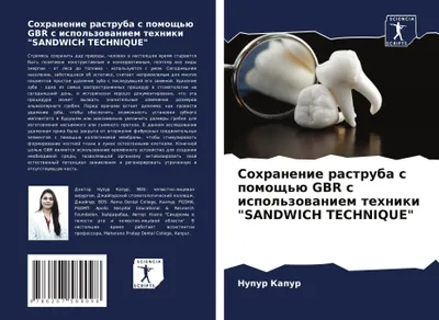 Produktbild von Sohranenie rastruba s pomosch'ü GBR s ispol'zowaniem tehniki "SANDWICH TECHNIQUE"