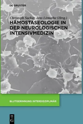 Produktbild von Hämostaseologie in der neurologischen Intensivmedizin