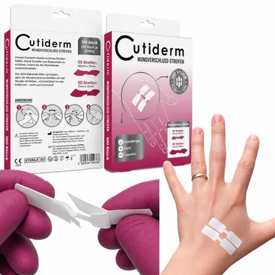 Immagine prodotto di Cutiderm Set da 100 strisce per sutura della ferita / cerotti a farfalla / strisce di chiusura per ferite