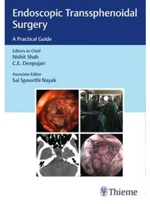Obrázek produktu pro Endoscopic Transsphenoidal Surgery