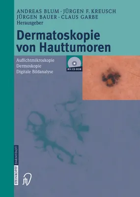 Image de Dermatoskopie von Hauttumoren