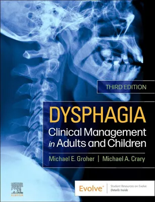 Produktbild von Dysphagia