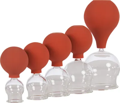 Produktbild von Schröpfgläser mit Ball Schröpfglas Schröpfset mit Saugball ø 2,5-6,5 cm, 5er Set