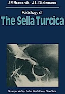 Image de Radiologie de la selle turcique