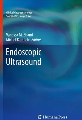 Zdjęcie produktu dla Endoscopic Ultrasound