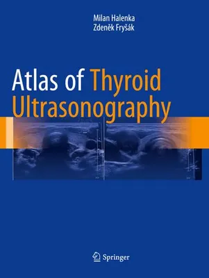 Produktbild von Atlas of Thyroid Ultrasonography
