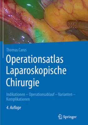 Image de Operationsatlas Laparoskopische Chirurgie