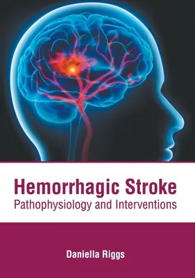 Produktbild von Hemorrhagic Stroke