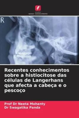 Produktbild von Recentes conhecimentos sobre a histiocitose das células de Langerhans que afecta a cabeça e o pescoço
