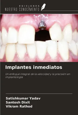 Produktbild von Implantes inmediatos