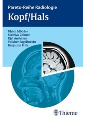 Produktbild von Kopf / Hals
