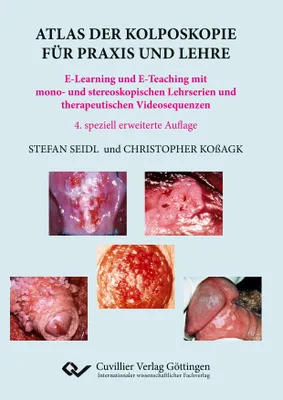 Produktbild von Atlas der Kolposkopie für Praxis und Lehre. E-Learning und E-Teaching mit mono- und stereoskopischen Lehrserien und therapeutischen Videosequenzen