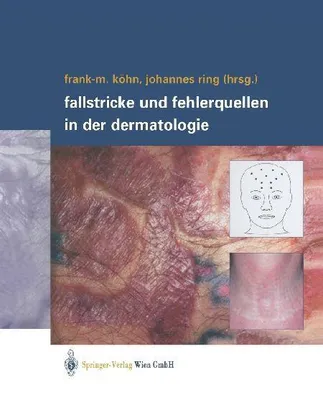 Produktbild von Fallstricke und Fehlerquellen in der Dermatologie