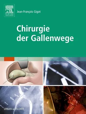 Produktbild von Chirurgie der Gallenwege