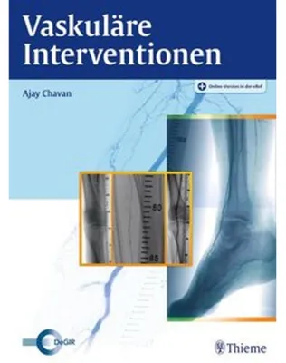 Produktbild von Vaskuläre Interventionen