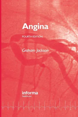 Produktbild von Angina