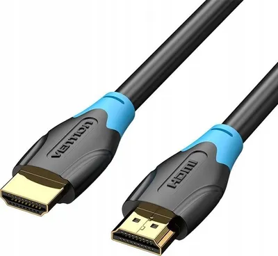 Produktbild von Vention AACBH HDMI Kabel 2m Schwarz High Speed