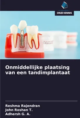 Produktbild von Onmiddellijke plaatsing van een tandimplantaat